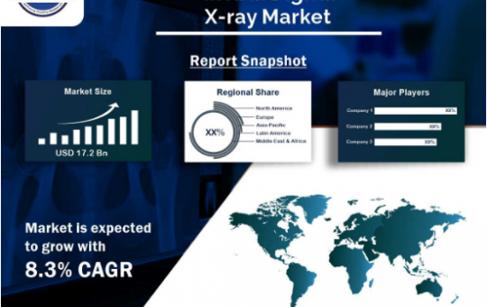 Digital X-Ray Market